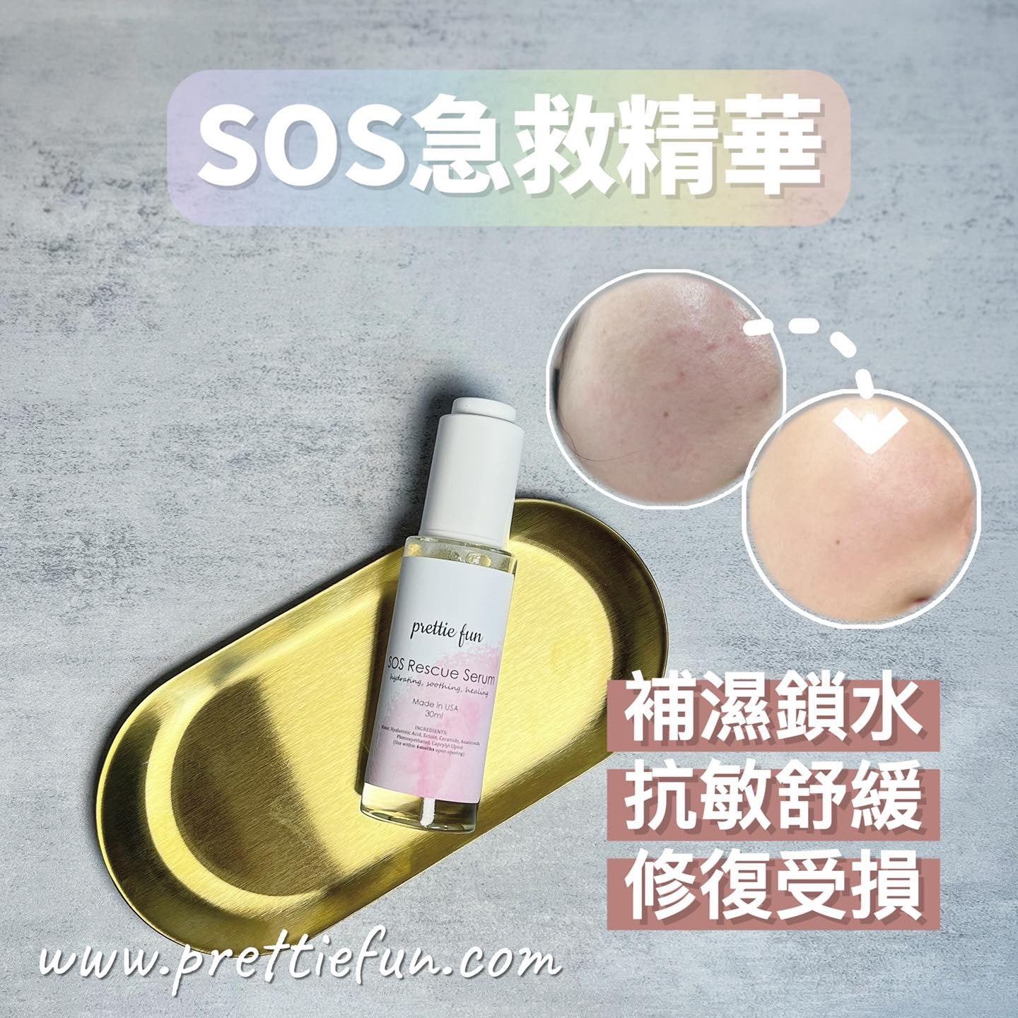 SOS急救精華 30ml (水潤+鎖水+修護)