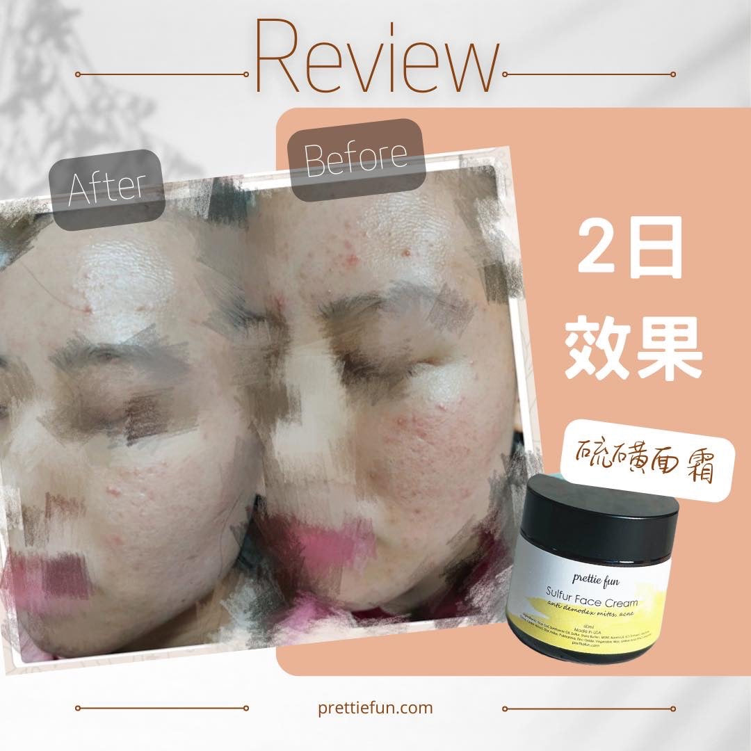 天然硫磺面霜-日常用 (毛囊蟎蟲&暗瘡) 60ml