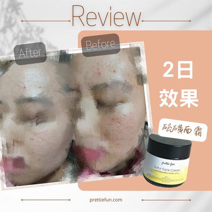 天然硫磺面霜-日常用 (毛囊蟎蟲&暗瘡) 60ml